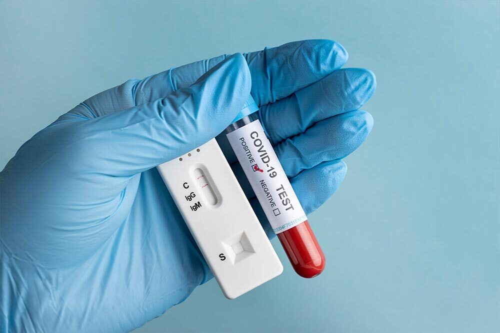 Molecular/PCR image